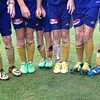 May 18, 2014: NASA Academy Heath show off their "soccer slogging" legs after their "mud bowl" game. (photo courtesy of the Faklaris family.