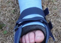 Reese foot injury